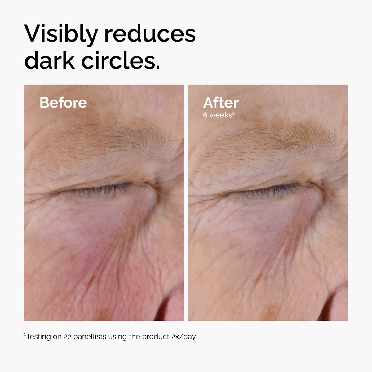 caffeine-solution-5-egcg-eye-serum-g0 ord-caffeine-solution-egcg-dark-circles-before-after.jpg