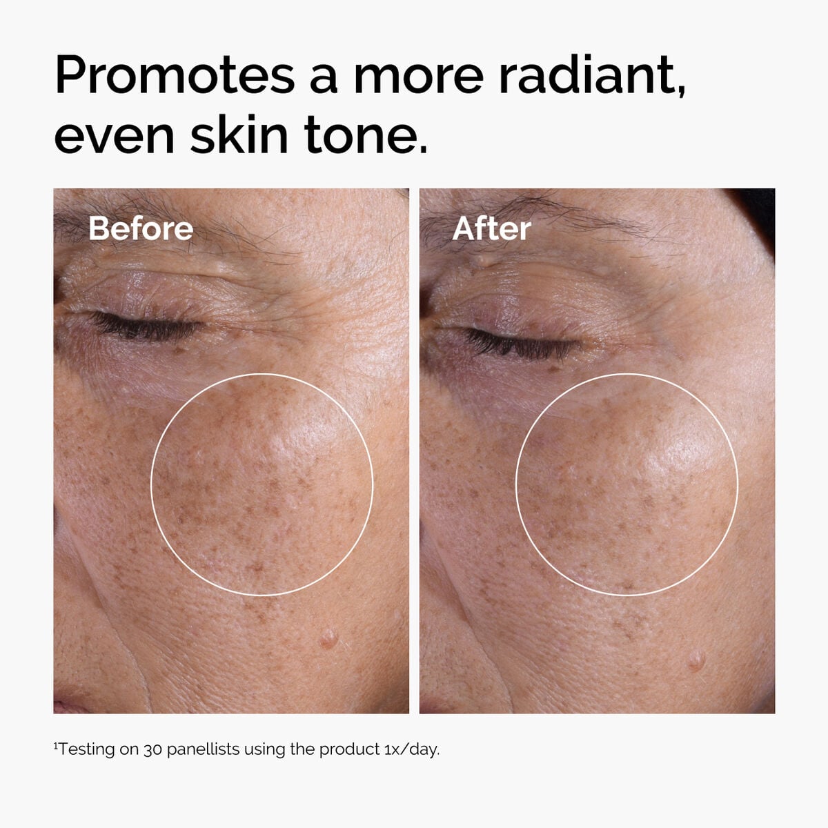 glycolic-acid-7-exfoliating-toner-k0 ord-glycolic-before-after-radiance.jpg