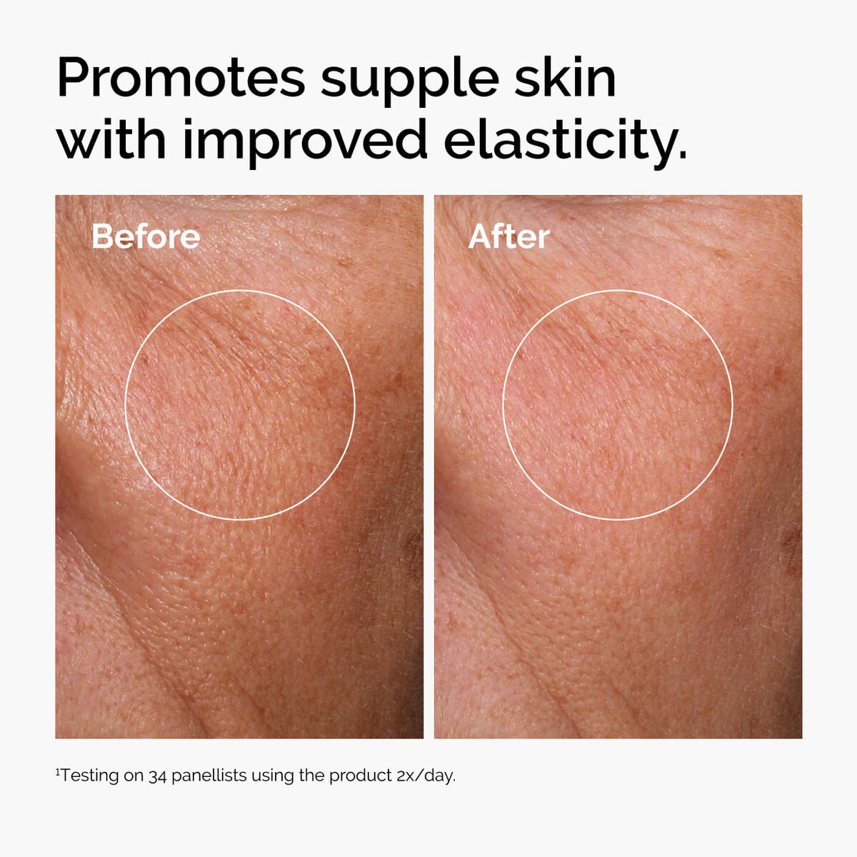 hyaluronic-acid-2-b5-with-ceramides-u6 ord-hyaluronic-acid-2pct-b5-hydrating-serum-before-after-elasticity.jpg