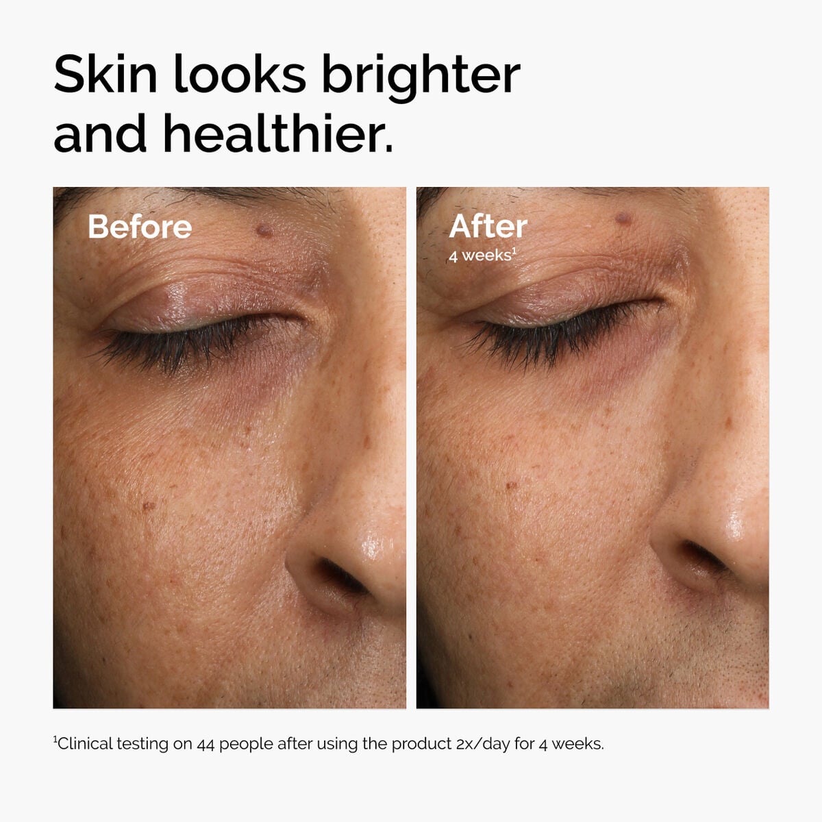 multi-antioxidant-radiance-serum-m0 ord-mars-before-after-healthy.jpg