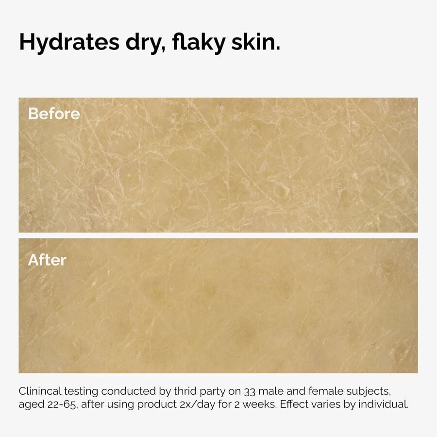 the-body-care-collection-p7 ord-natural-moisturizing-factors-inulin-body-before-after-graphic-02.jpg