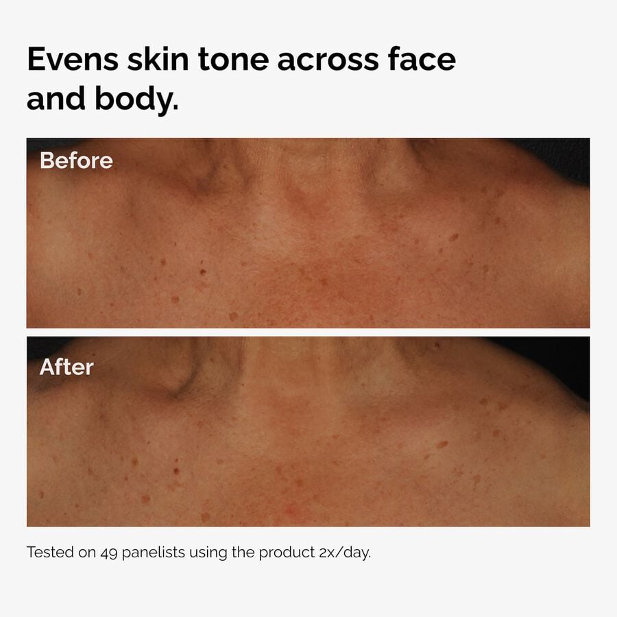 the-body-care-collection-p7 ord-niacinamide-face-body-serum-before-after-even-tone-graphic.jpg