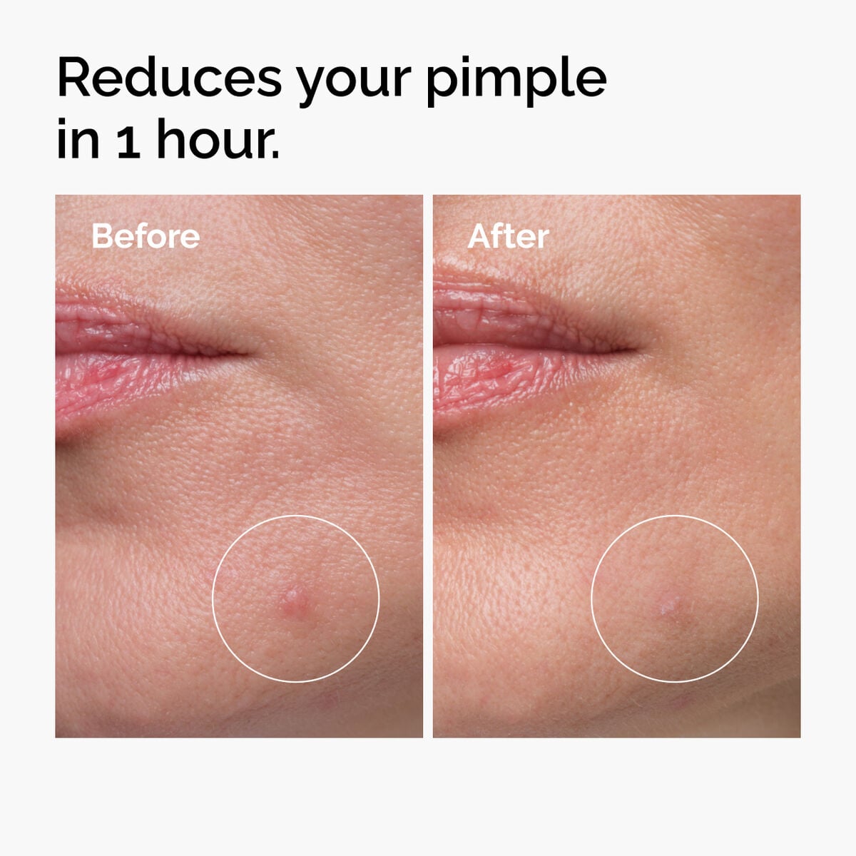 sulfur-10-powder-to-cream-concentrate-b8 ord-sulfur-10pct-powder-to-cream-concentrate-before-after-NA.jpg